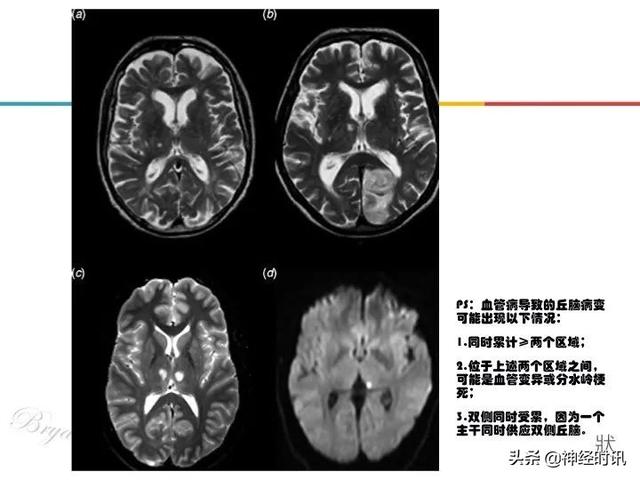 丘脑解剖结构图及功能（丘脑的解剖生理功能）(21)