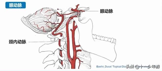 脑血管解剖结构图（概述和血管解剖）(24)