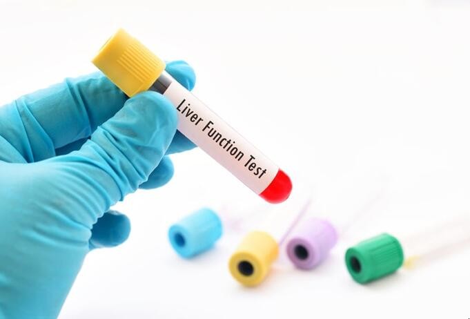 肝功能child分级