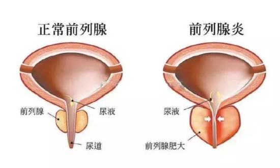 抬不起头