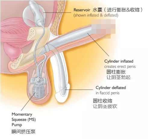 想硬就硬、想软就软。