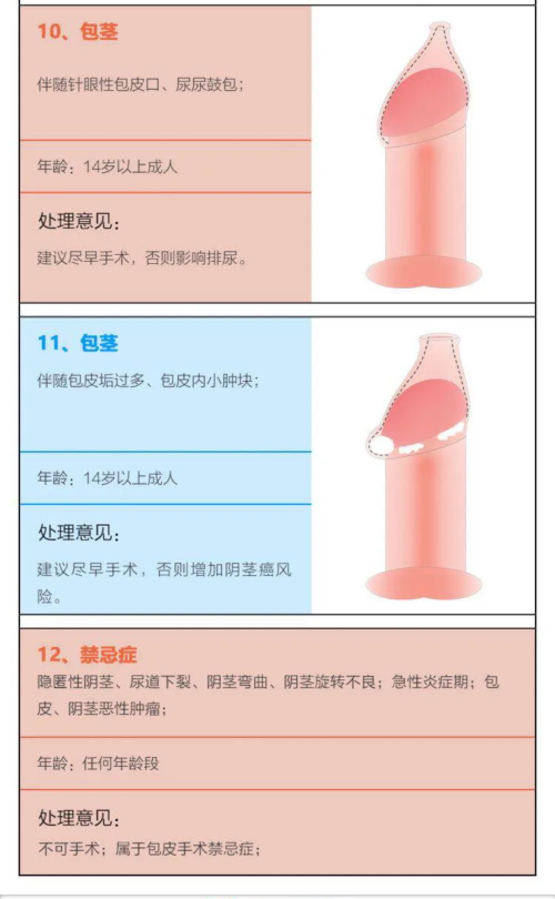 如何判断包皮是否过长