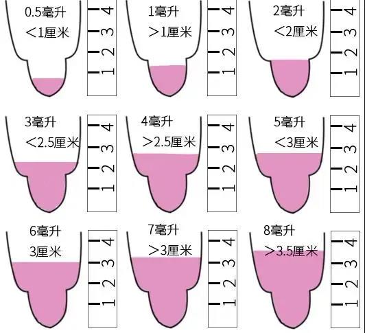 精子量参照图