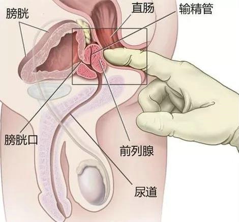 前列腺位置