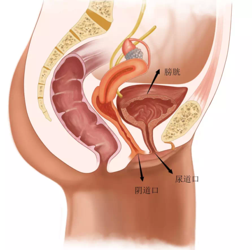 尿道、阴道不是一个口