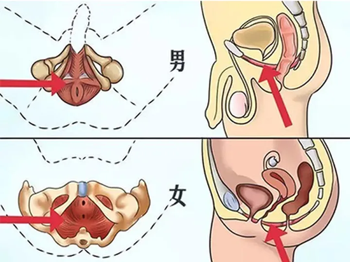 凯格尔＝提肛运动