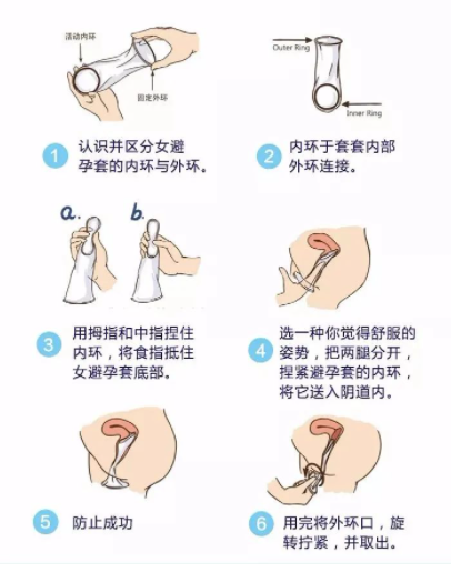 女用安全套该怎么用