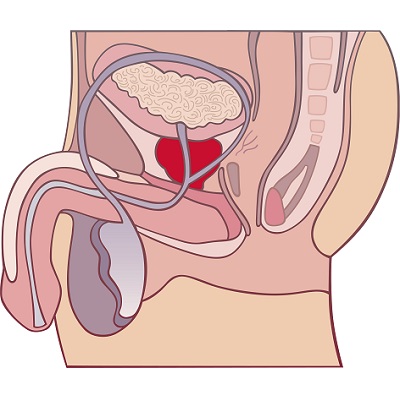 前列腺