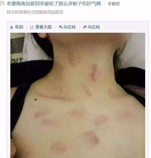 怎么吻才能种出草莓