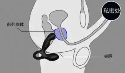 前列腺快感到底是怎样的
