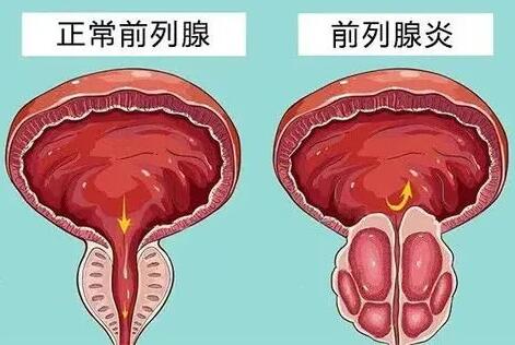 射出血了是怎么回事