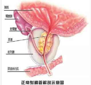 射出血了是怎么回事