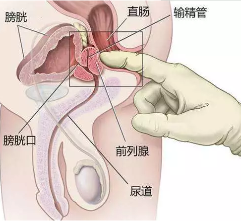 前列腺膏潮真的比射精还爽是真的吗