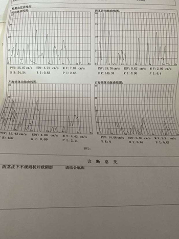 擦什么药能降低龟头