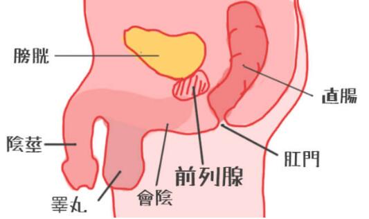 如何前列腺膏潮