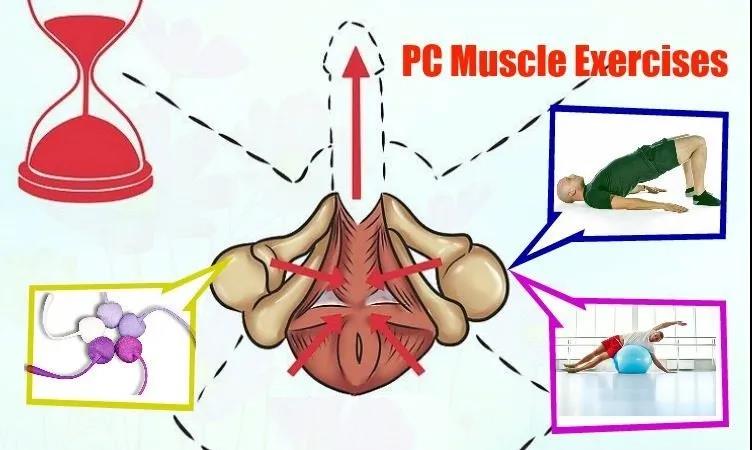 凯格尔运动真能提升性功能吗