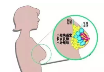 良性乳腺瘤手术后吃啥东西好