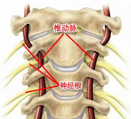 颈椎病有哪些类型怎么治