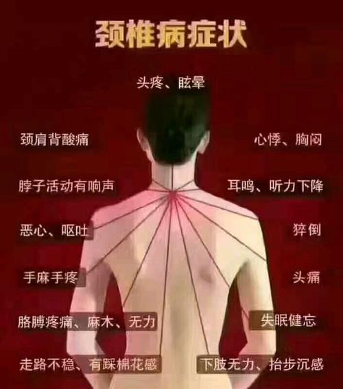 颈椎病怎么治疗好有哪些方法