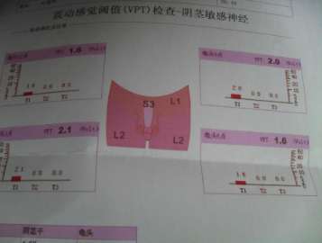 百交不泄秘方一味药