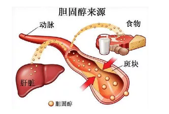 高胆固醇的食物有哪些?