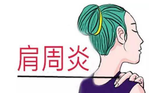 肩周炎如何治疗肩周炎疼痛怎么办