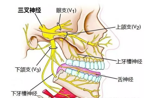 三叉神经痛症状表现是哪个部位图片