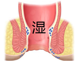 肛门周围潮湿瘙痒是什么原因 