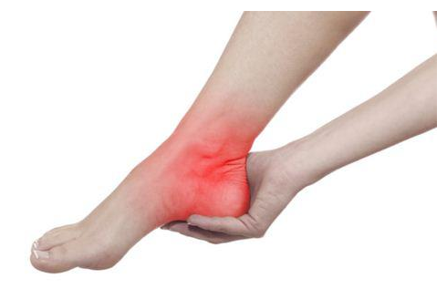 崴脚了一般多久能好 怎么快速消肿止痛