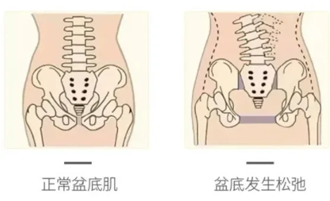 是不是所有女孩都会夹