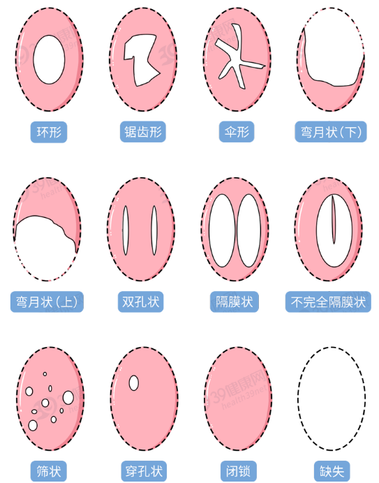 怎么鉴别女朋友是不是处的