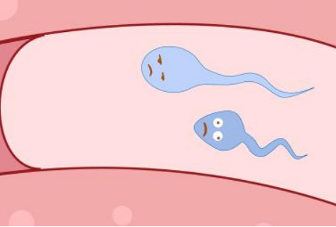 多囊女和少精男，究竟要不要继续