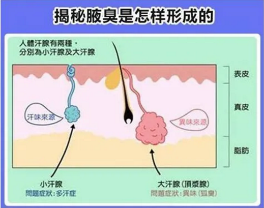 人身上的体味怎么来的