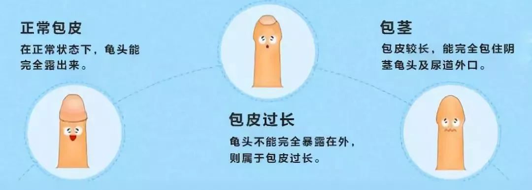 男的第一次会疼吗