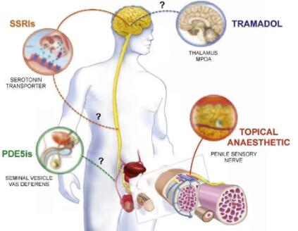 男人对抗性功能障碍的方法有哪些