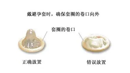 日常如何正确避孕，降低意外怀孕的几率呢