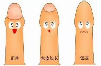 男生第一次会痛吗