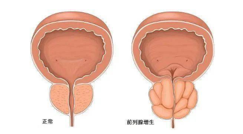 老公那东西越来越大怎么办