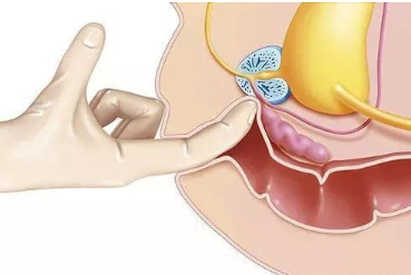 前列腺按摩什么感觉