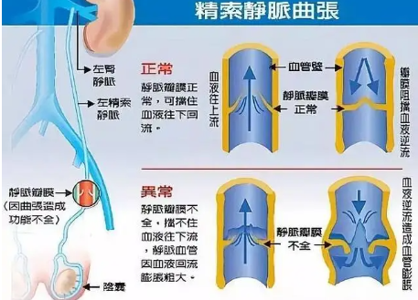 蛋蛋上面有青筋是怎么回事