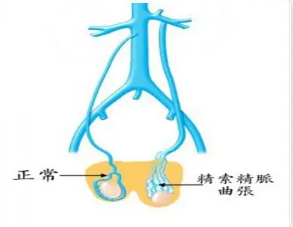 蛋蛋上面有青筋是怎么回事