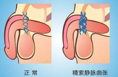 蛋蛋上面有青筋是怎么回事