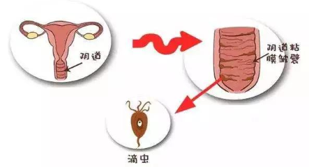 下面总是噗噗的响