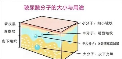 避孕套内含玻尿酸的作用与危害