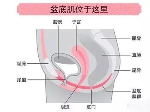 生完孩子漏尿做盆底肌修复有用吗