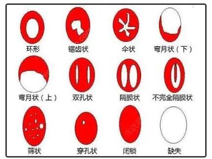 只发生过1次关系能隐瞒吗