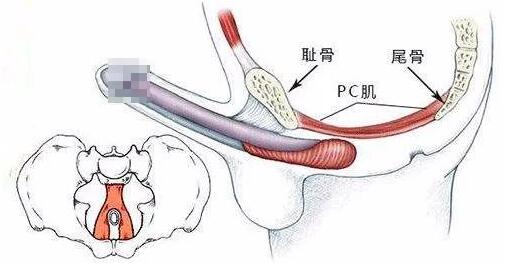 延时助勃的药物哪一种好