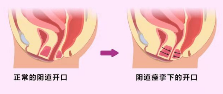 女生太紧是种怎样的体验