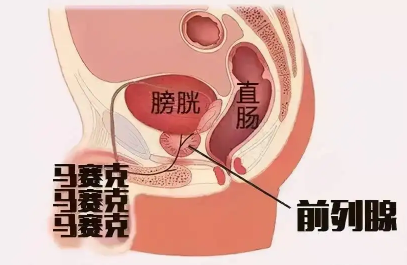 按摩前列腺有什么好处和坏处