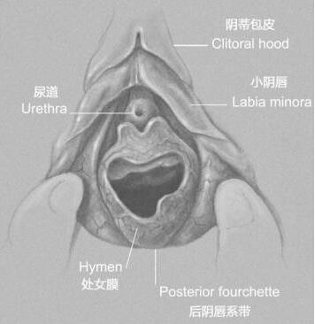 处nu膜是怎样才算破了